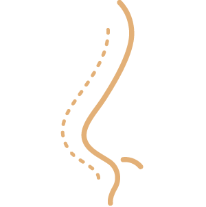 RINOSPLASTIA